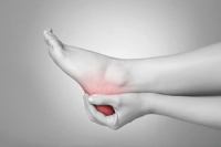 An Injury or Overuse May Lead to Plantar Fascitiis